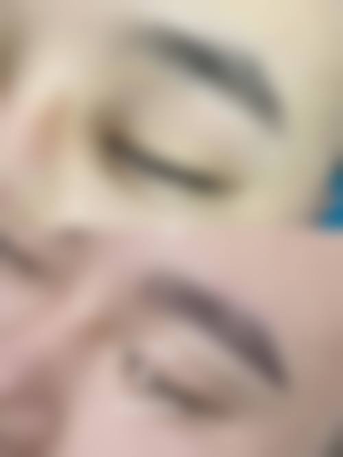 太原华美整形医院植发真人口碑评价怎么样？