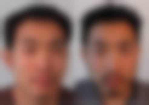 周书茵医生预约挂号