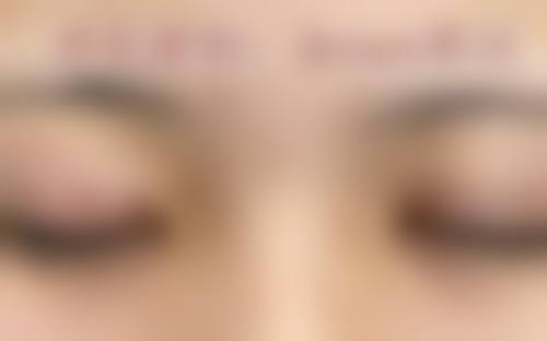 深圳北大医院整形科收费价格表/收费标准