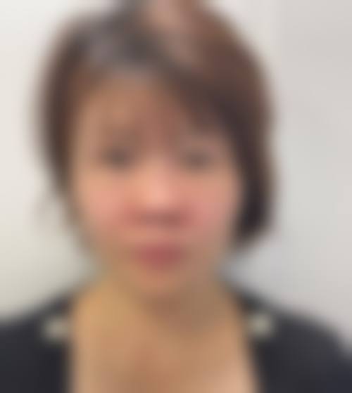 衢州伊美医疗美容门诊部详细的预约挂号方式及流程