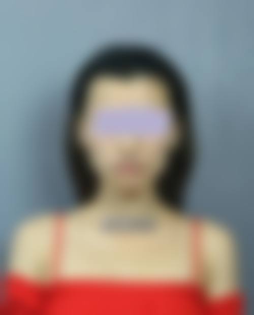 深圳北大医院整形科特色项目及技术优势