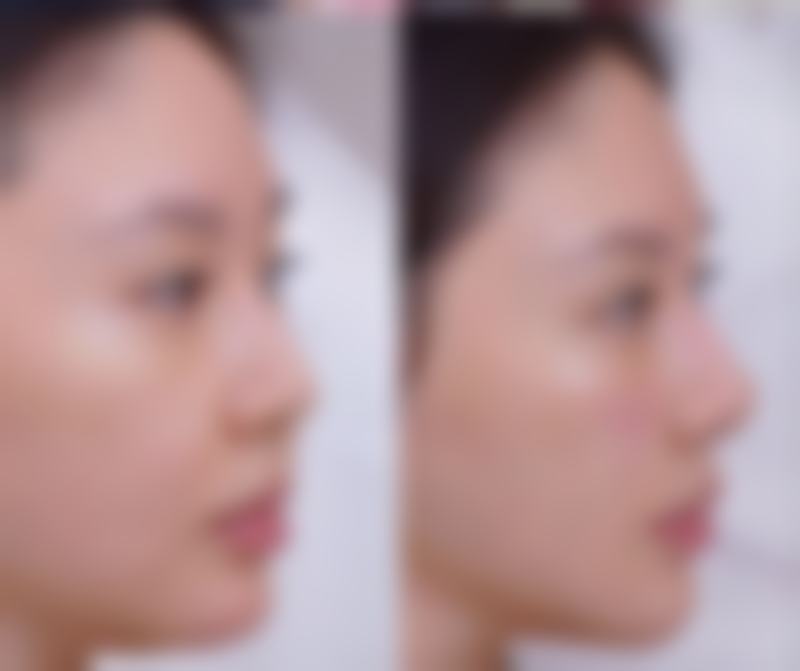 衢州伊美医疗美容门诊部收费价格表/收费标准