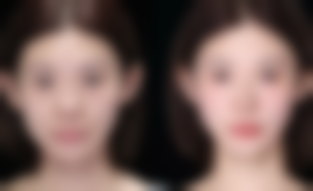 南京医美整形医院哪家更靠谱？美莱、华美口碑好，美莱眼综合、华美肋骨鼻技术出色！ 