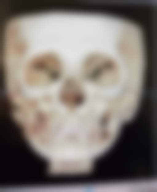 饮食调理：从内而外滋养眼部