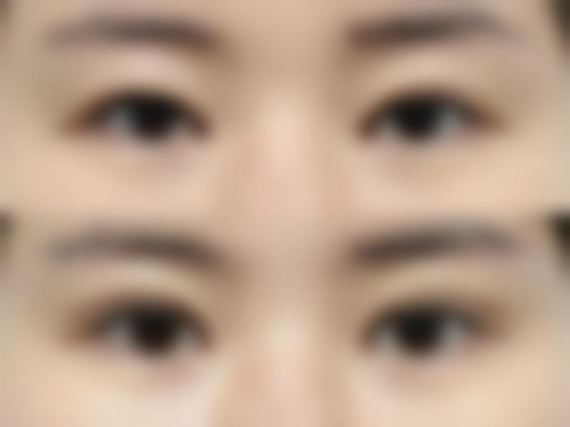 上海颜净是渠道医院吗？不是，它资质正规、价格透明，赵鹏医生技术获众多顾客好评！ 