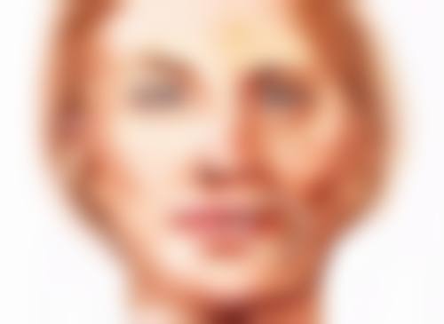 手术治疗:直接切除顽固疤痕疙瘩