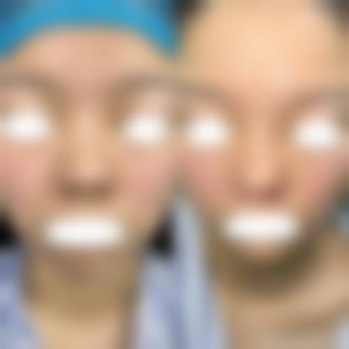 宁波鄞州蔚汀整形医院真人口碑评价怎么样?