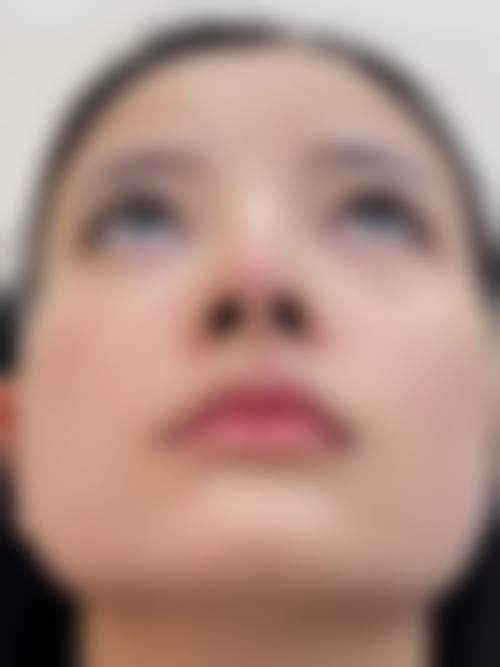 舟山周凤整形医院收费价格表/收费标准