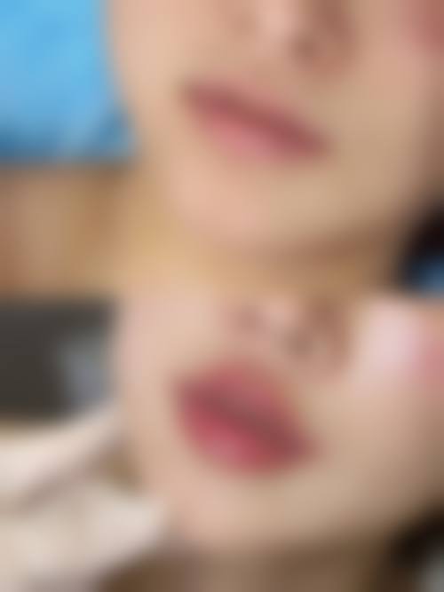 台北唯美医美整形诊所特色项目及技术优势