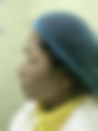 台北唯美医美整形诊所收费价格表/收费标准