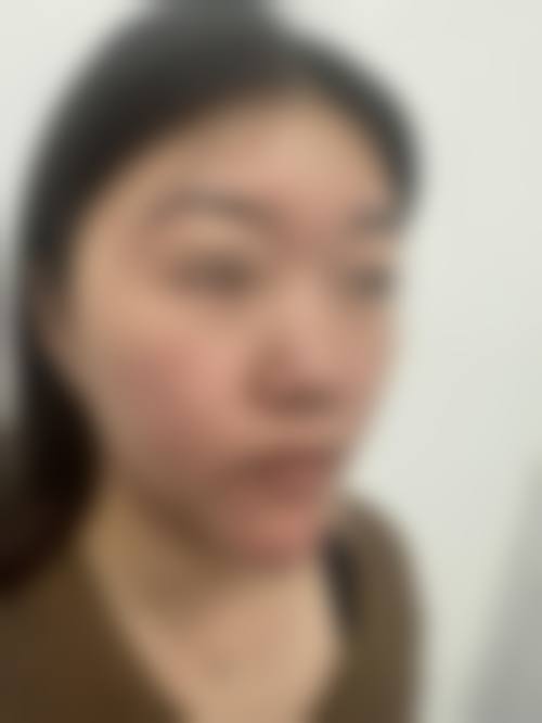 刘金超医生的技术优势