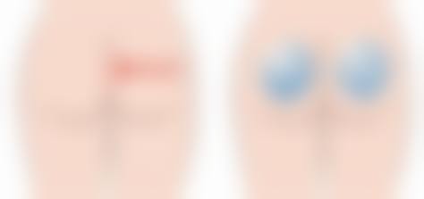 价格与注意事项