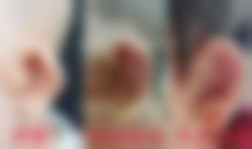 TCB 川口医院详细的预约挂号方式及流程