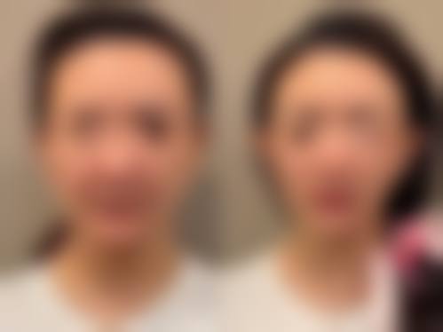 厦门兰的整形美容门诊部真人口碑评价怎么样?