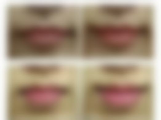 祛疤注意事项:谨慎选择,确保治疗成效