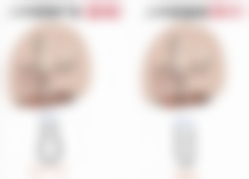 避免大腿环吸抽脂反弹的实用秘籍