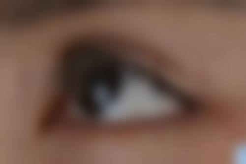 隆胸假体选择攻略:综合考量选对品牌