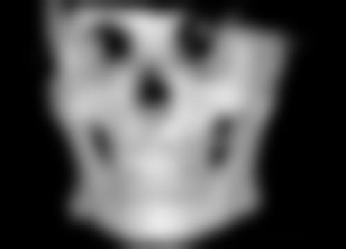 手术治疗：精细切除重塑理想肌肤