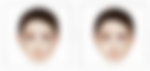 凹进去的手术疤痕能长平吗？≤1mm浅层3-6个月可长平，深层需医美干预改善