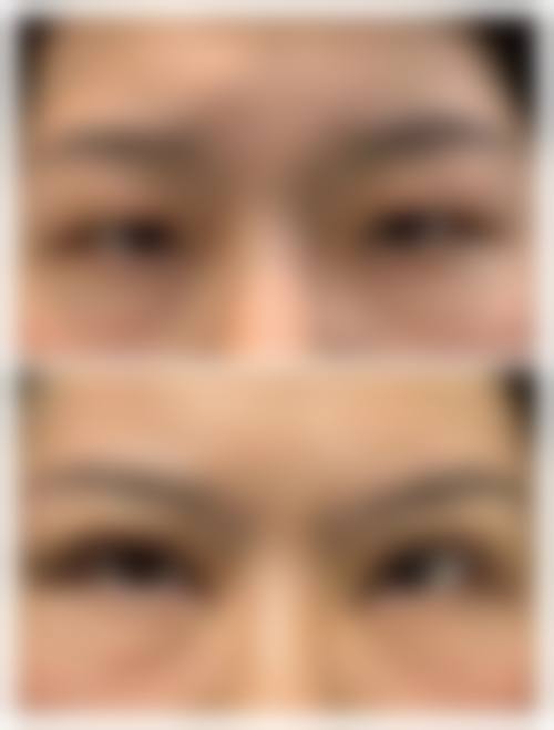 热门整形项目收费