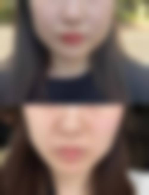 成都亚鑫时尚医美诊所收费价格表/收费标准