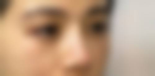 长春华玺整形医院收费价格表/收费标准