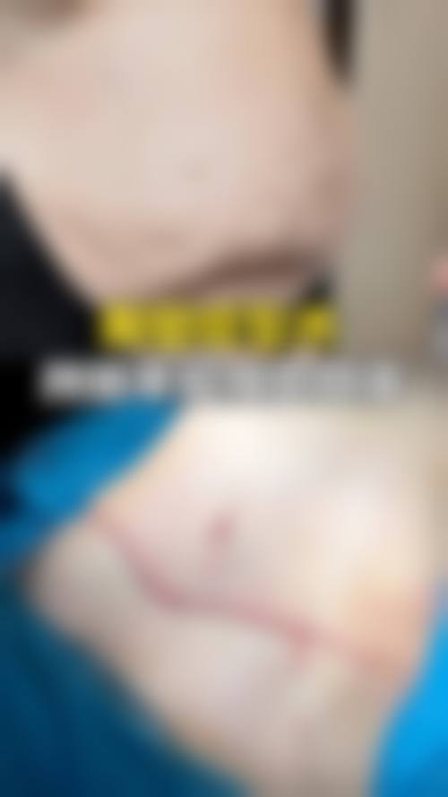 西安玛莲伦娜整形医院详细的预约挂号方式及流程