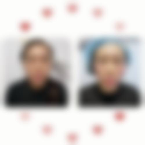 杨玉兰医生技术优势