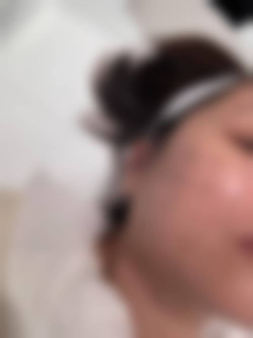 2026南方医科大学南方医院整形外科价目表：双眼皮1800起、隆鼻3000起，技术优口碑好！ 