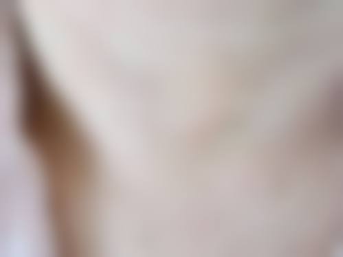 市一院的祛疤特色