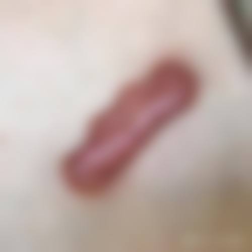 挂不上号的备选方案