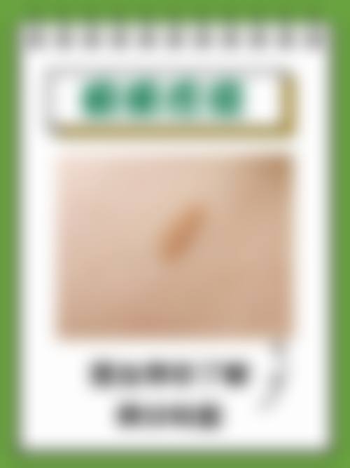 治疗价格与术式参考