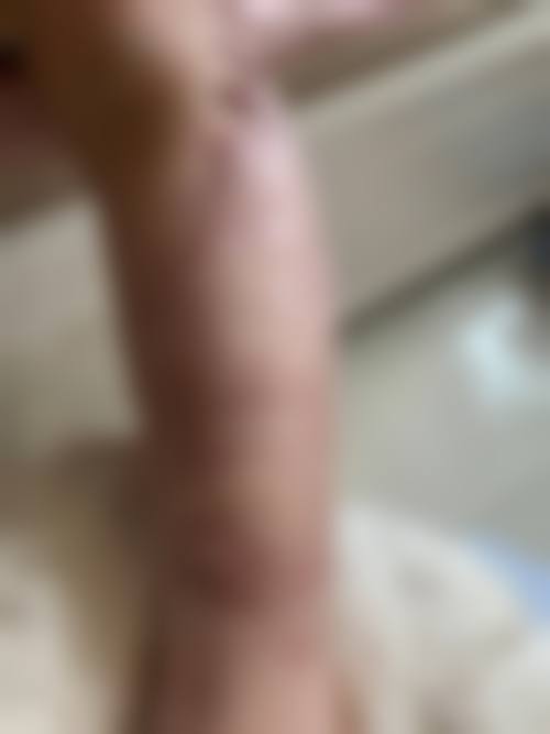 LCR治疗技术解析