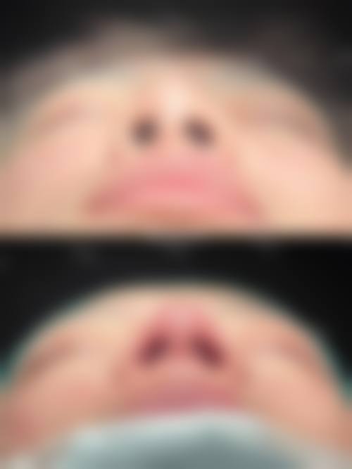 上海纽菲思星灿美容门诊部真人口碑评价怎么样?