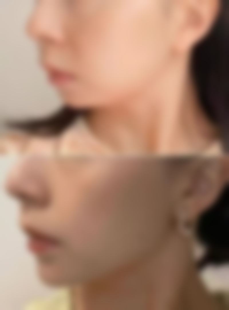 术后护理与患者评价