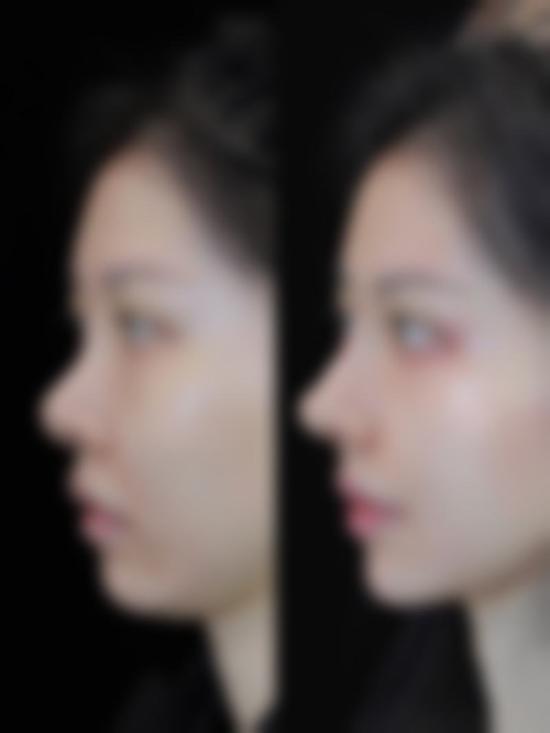 陶洪文医生技术优势