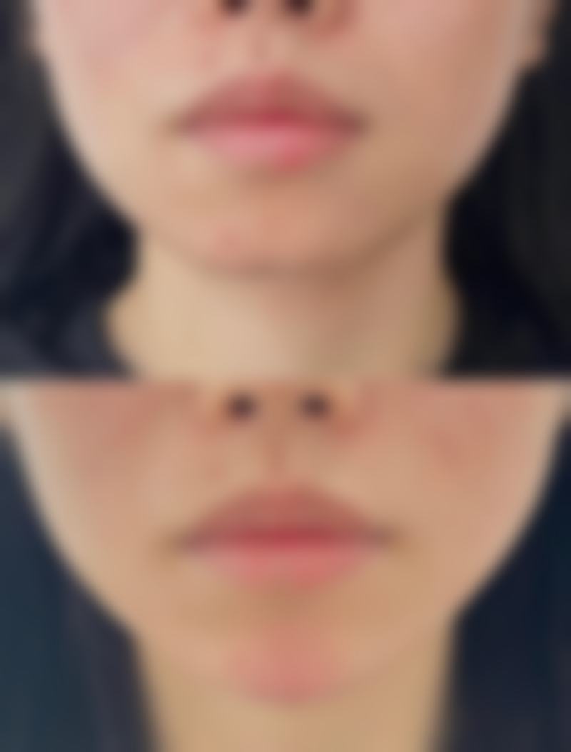 长春华玺整形医院详细的预约挂号方式及流程