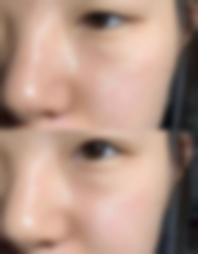 经济适用王牌:美国曼托假体大揭秘