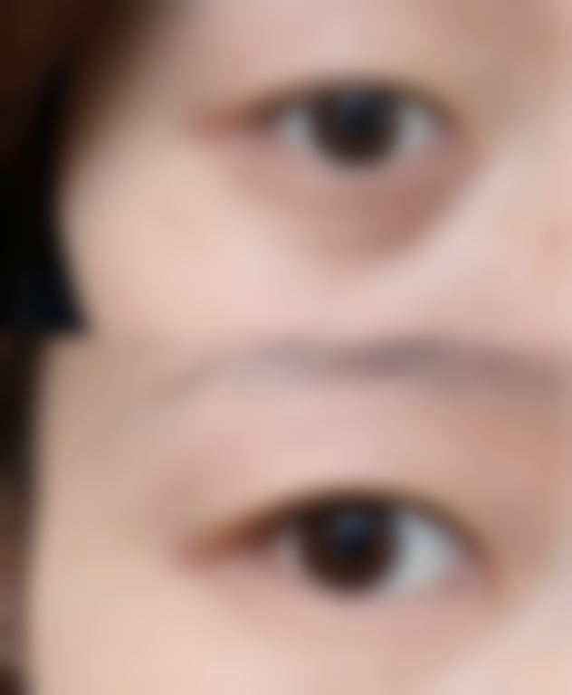 中医调理方法:温和改善眼袋状况