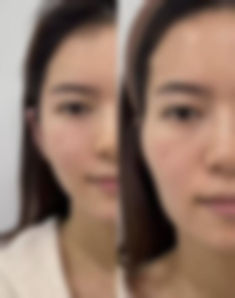 珠海艾瑞医疗美容门诊部:眼部整形佼佼者