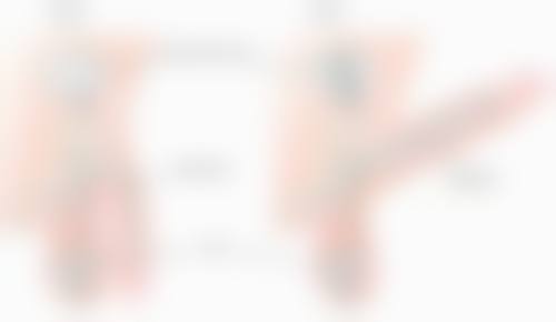 复查随访：定期复查，及时解决修复问题