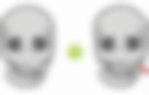 选对眼型：为双眼皮埋线手术安心加分