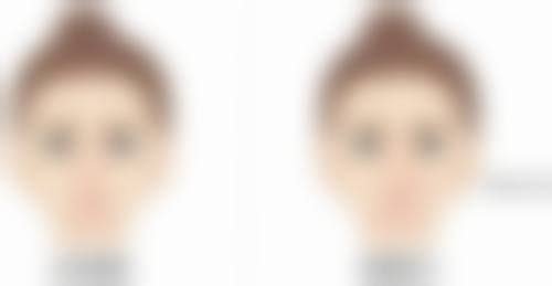 改善疤痕影响的有效方法