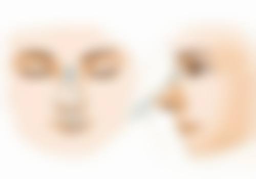 轻医美干预：适合轻中度增生的方法