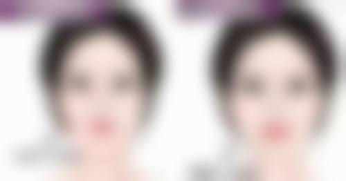 全方面解析：双眼皮埋线手术可能面临的风险