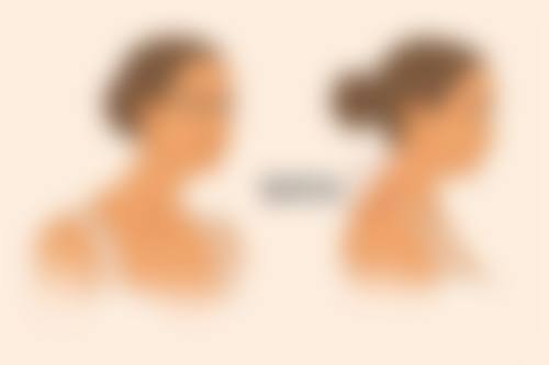 疤痕体质者做医美，如何选择医院和医生？