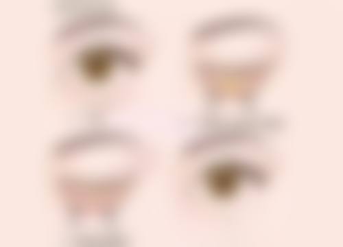 美诗沁去眼袋：个性化方案重塑眼部美丽