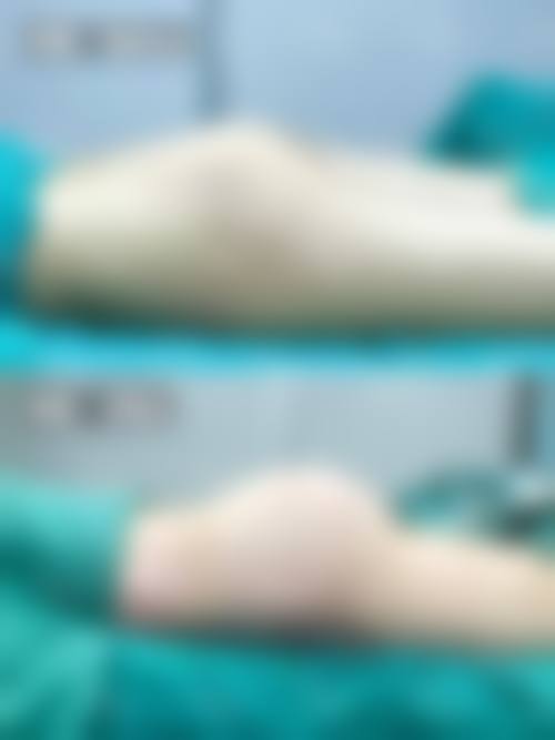 韩国SY整形外科特色项目及技术优势