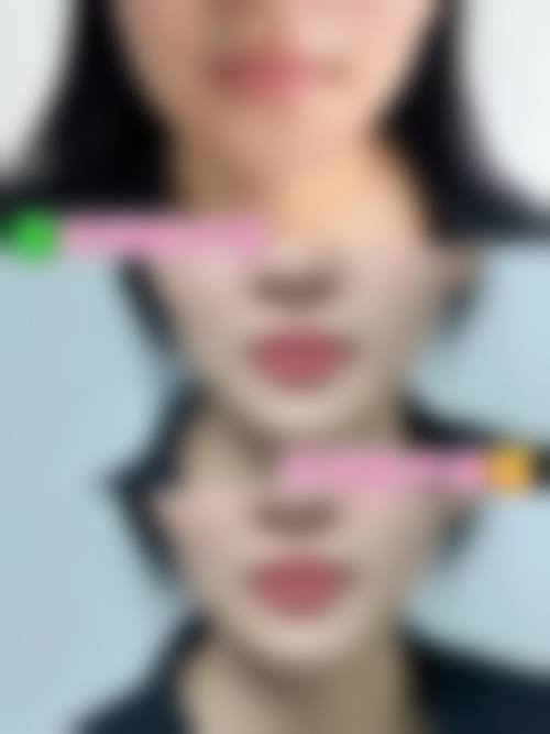 北京艺研丽整形医院收费价格表/收费标准