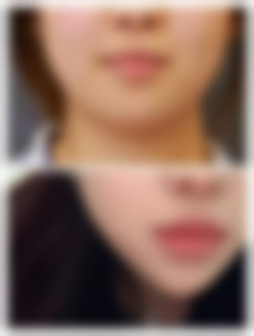 姜敏医生坐诊医院